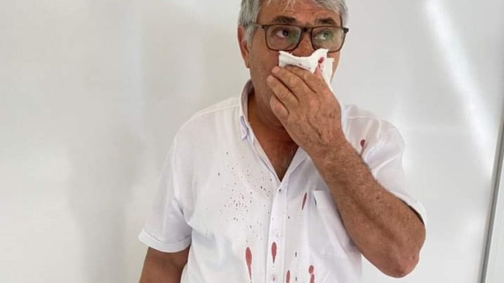 İzmir’de CHP’li Belediye Başkan Yardımcısı’ndan muhtara dayak