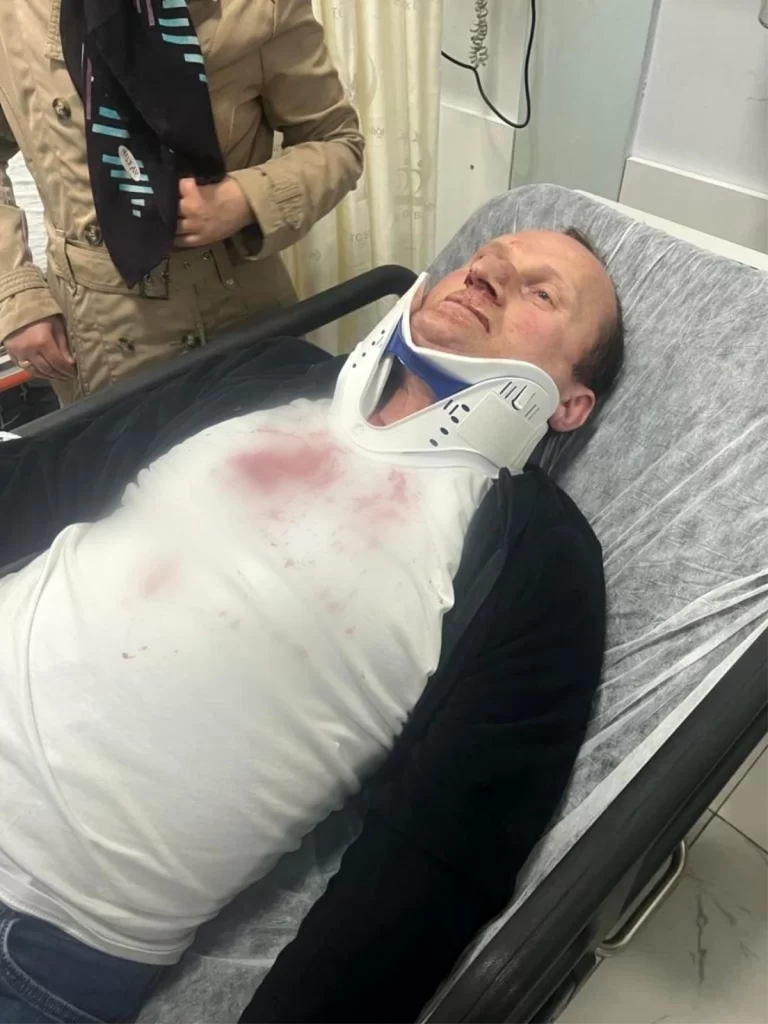 Samsun’da kırmızı ışıkta araç içinde darp edildi
